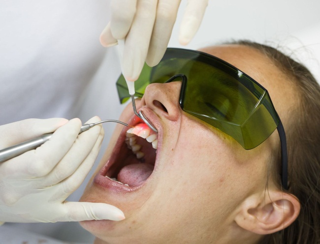 Лазерное лечение зубов в Москве