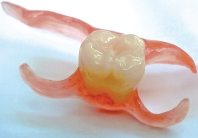 Съемный зубной протез на один зуб цена