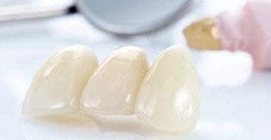 Описание, виды и назначение временных зубных протезов 