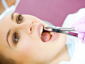 удаление зуба сложное